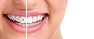 family dental care in schaumburg